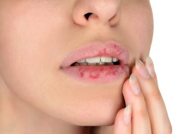 7 dalykai kas padaro jūsų lūpas sausomis